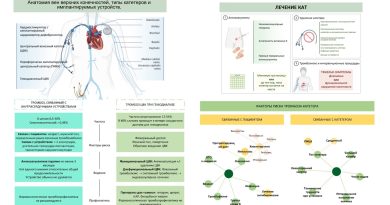 Всесторонний обзор катетер-ассоциированного тромбоза