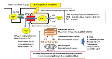 Руководство Японского общества анестезиологов 2025 года по лечению злокачественной гипертермии